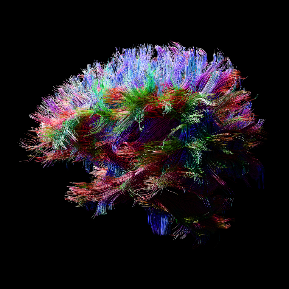 Tractography/Diffusion MRI image, The Learning Lab, Columbia Univ (사진제공: 이스탄불 디자인 비엔날레)